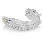 ProSomnus PH Herst Sleep Oral Appliance